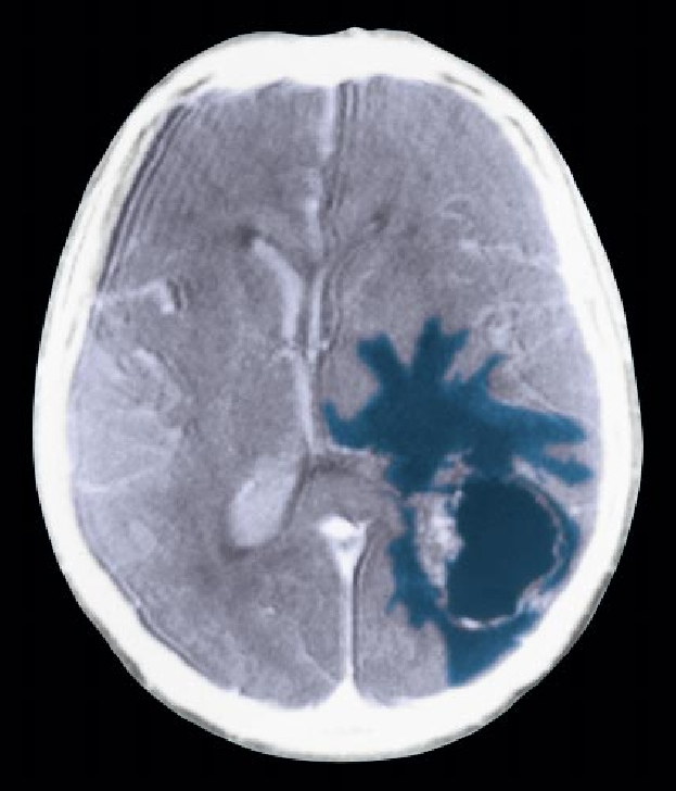 The Genetic Basis of Cancer-02.jpg