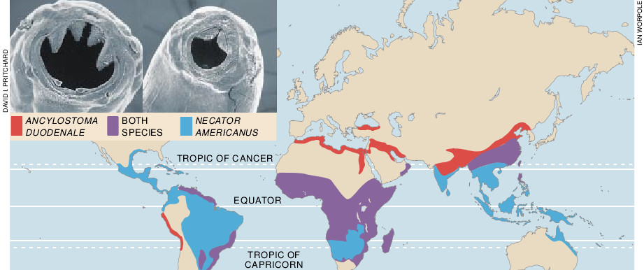 Hookworm Infection-03.jpg