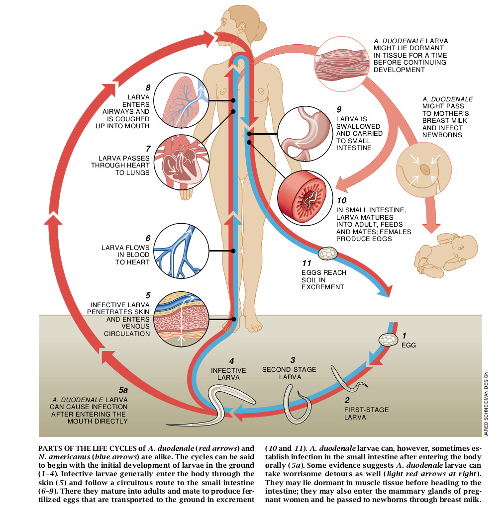 Hookworm Infection-06.jpg