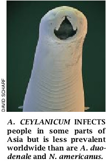 Hookworm Infection-07.jpg
