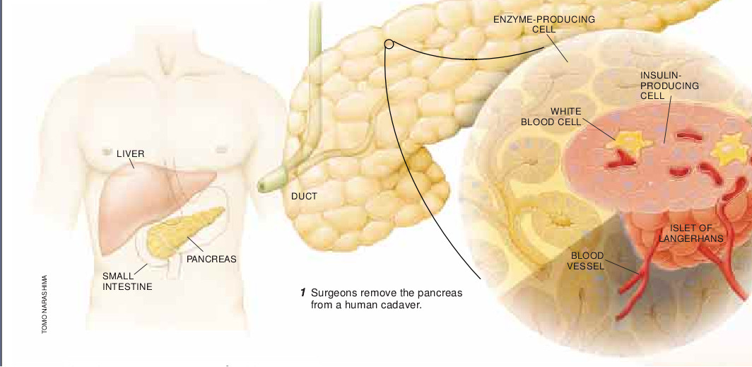 Treating Diabetes with Transplanted Cells-01.jpg