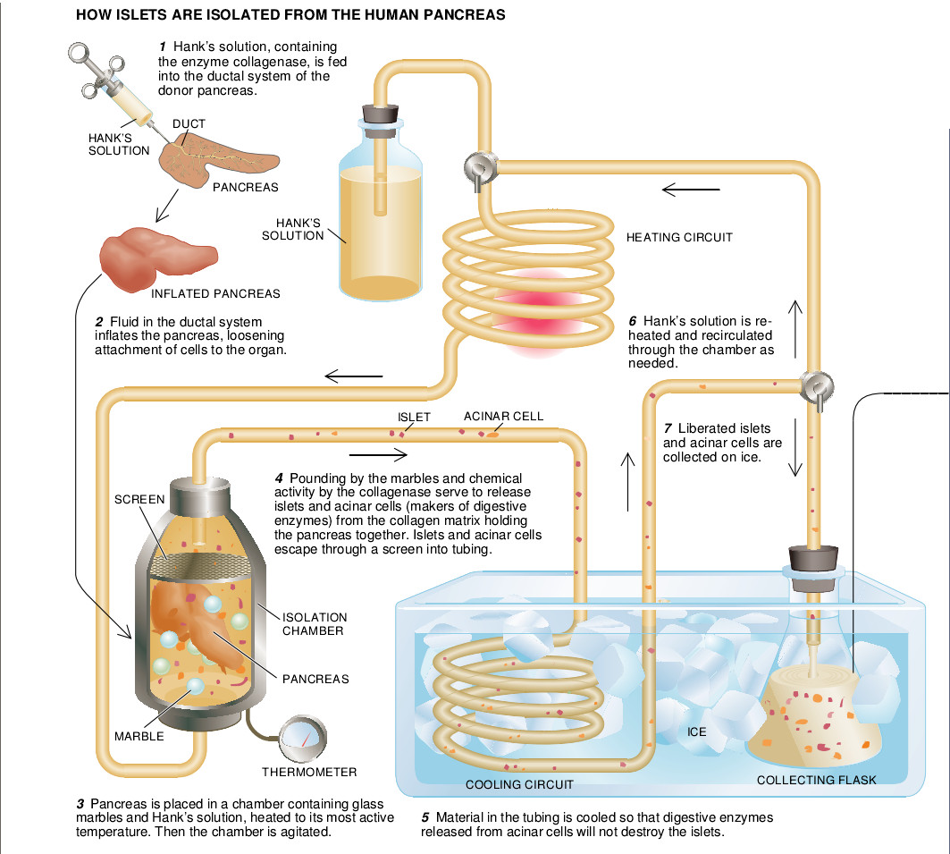 Treating Diabetes with Transplanted Cells-03.jpg