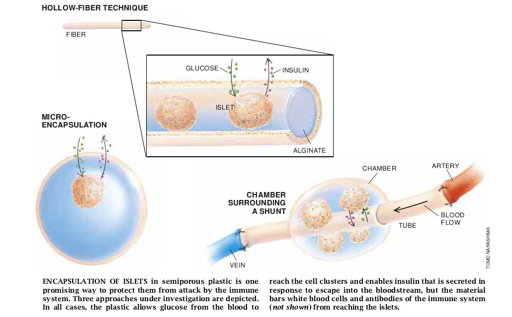 Treating Diabetes with Transplanted Cells-05.jpg