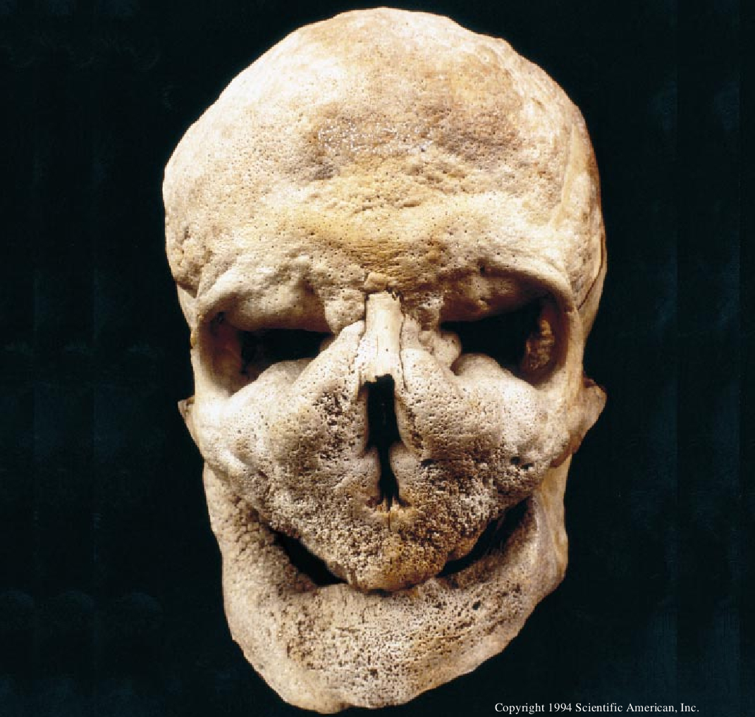 Egil's Bones-01.jpg