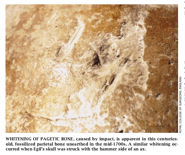 Egil's Bones-04.jpg
