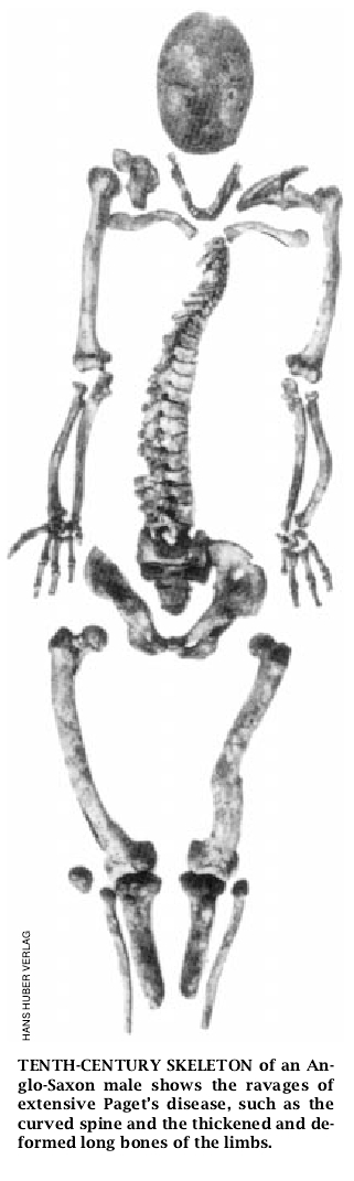 Egil's Bones-05.jpg