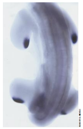 肢体怎样发育 7.png