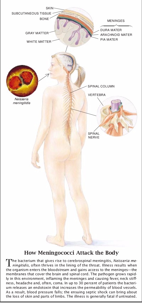 Cerebrospinal Meningitis Epidemics-04.jpg