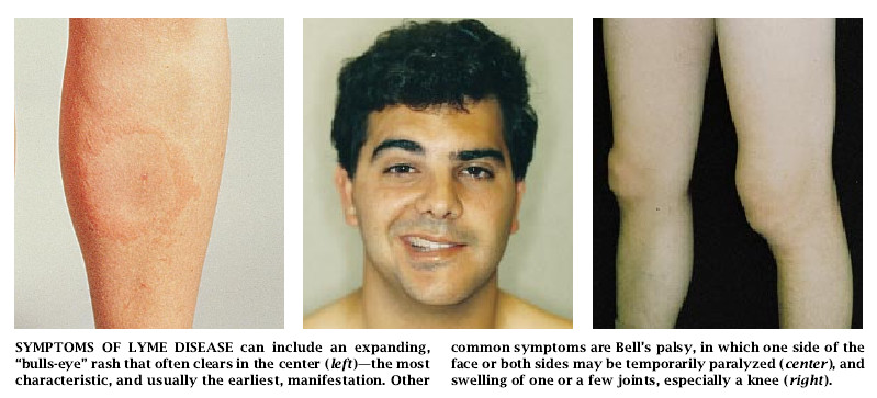 Disarming Lyme Disease-05.jpg
