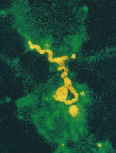 Disarming Lyme Disease-06.jpg