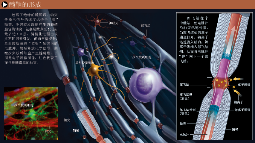 智力基石：大脑白质 (4).png