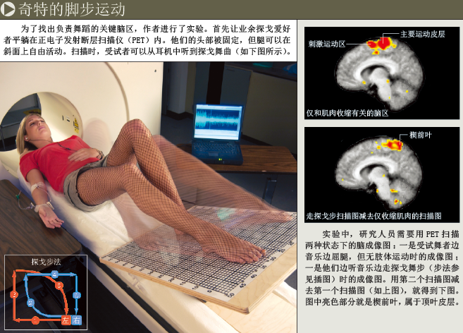 神经元之“舞” (3).png