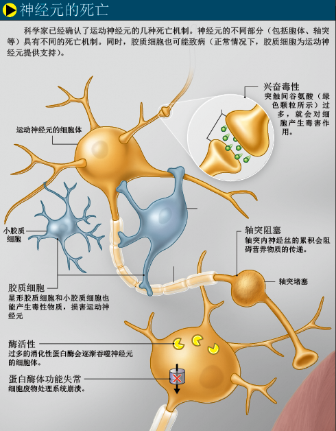 让霍金重新站起来 (2).png