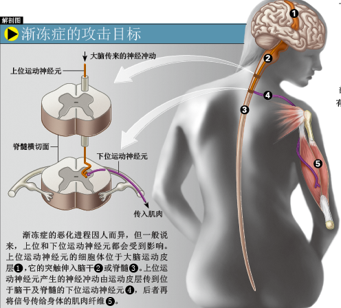 让霍金重新站起来 (3).png