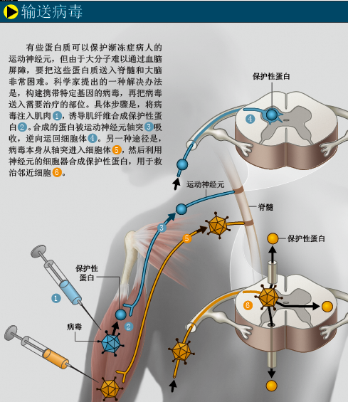 让霍金重新站起来 (5).png