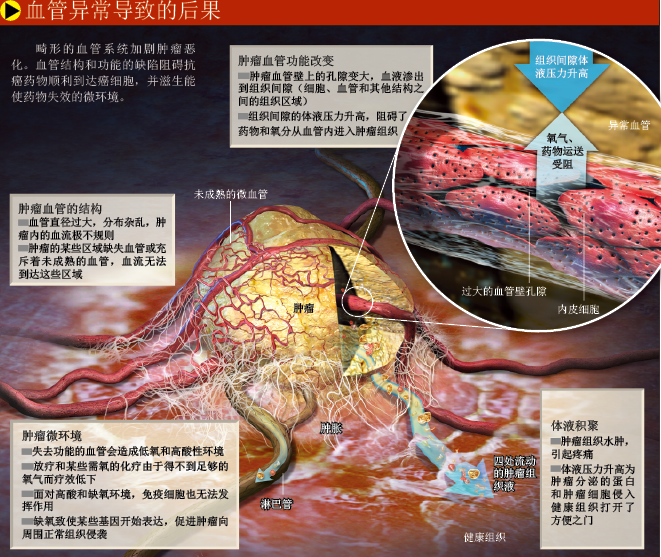 梳理血管  治癌新方法 (2).png