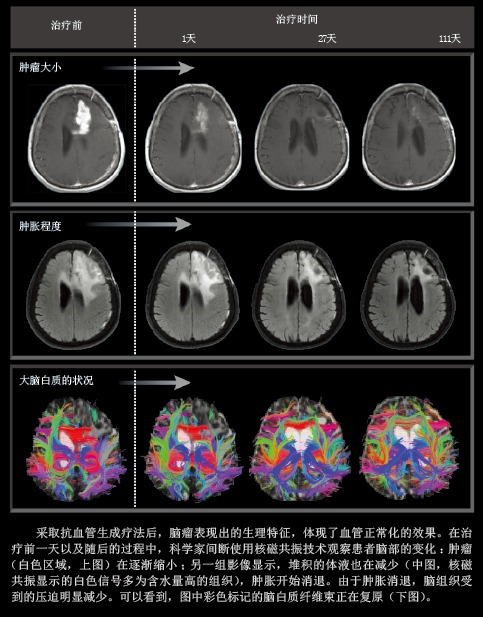 梳理血管  治癌新方法 (5).png