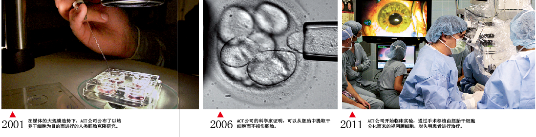 干细胞治疗的追梦者.png