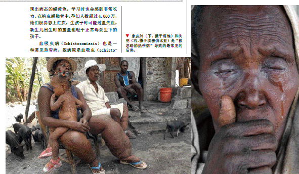 10亿人的抗争：遏制热带病 (2).png