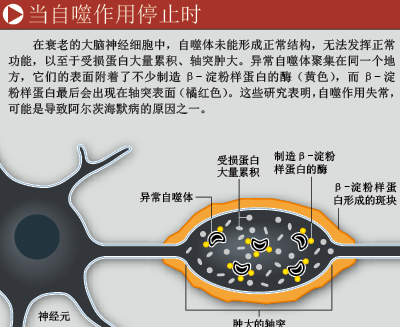 让病变细胞自杀 (4).png