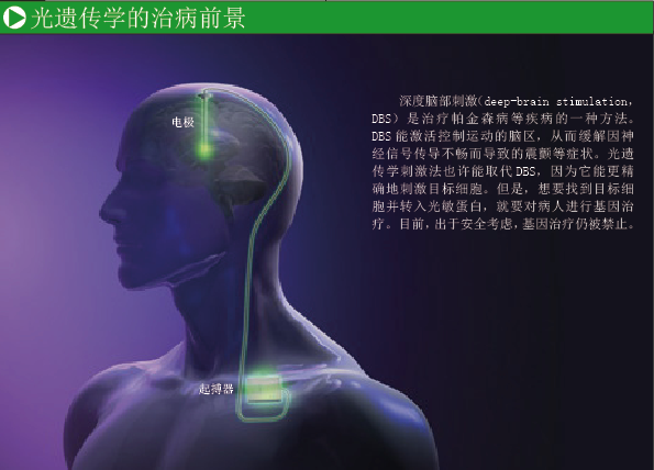 遥控大脑 (4).png