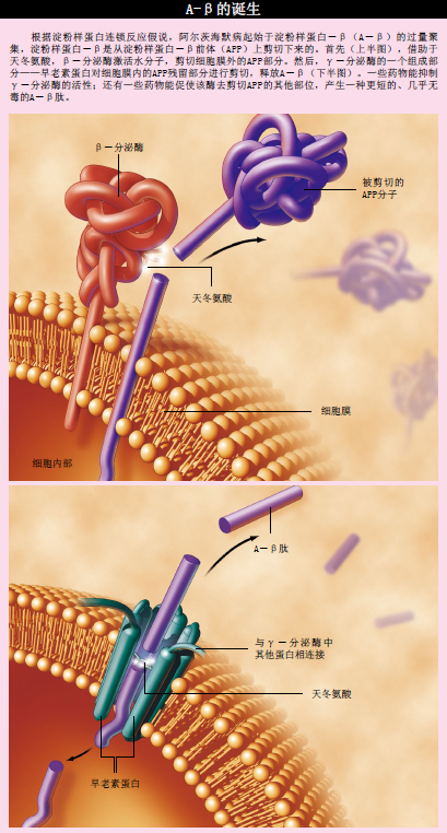 阿尔茨海默病 (2).png