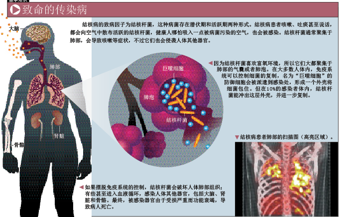 向超级结核杆菌宣战 (1).png