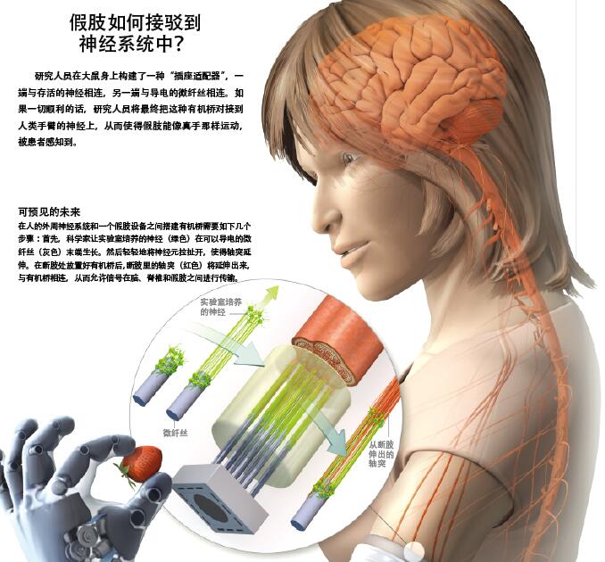 让假肢拥有神经 (1).jpg