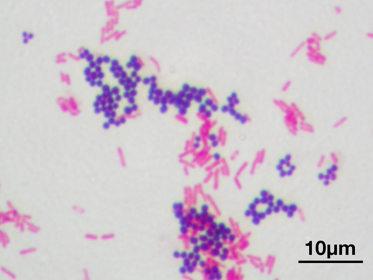 Gram_stain_01.jpg