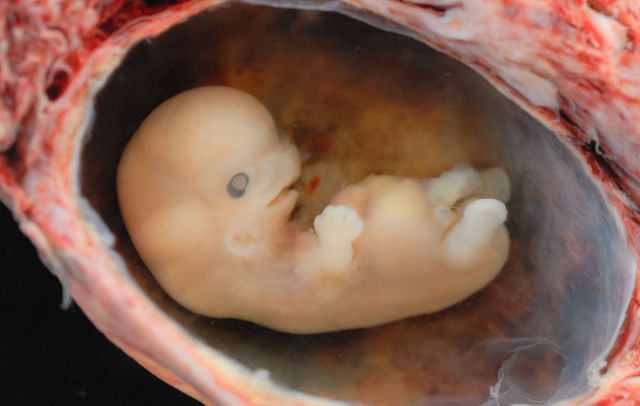 640px-Human_Embryo_-_Approximately_8_weeks_estimated_gestational_age.jpg