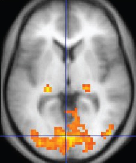 1206_FMRI.jpg