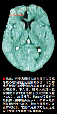 证明弗洛伊德 (3).png