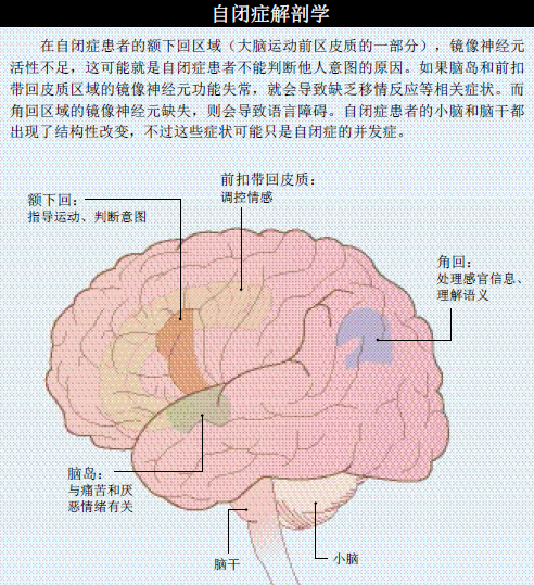 自闭症：碎镜之困 (1).png