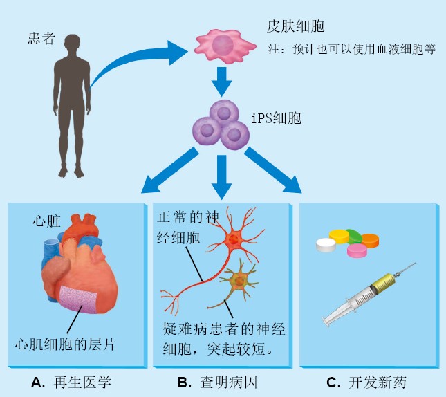 20130264走向实用化的iPS细胞_f1.jpg