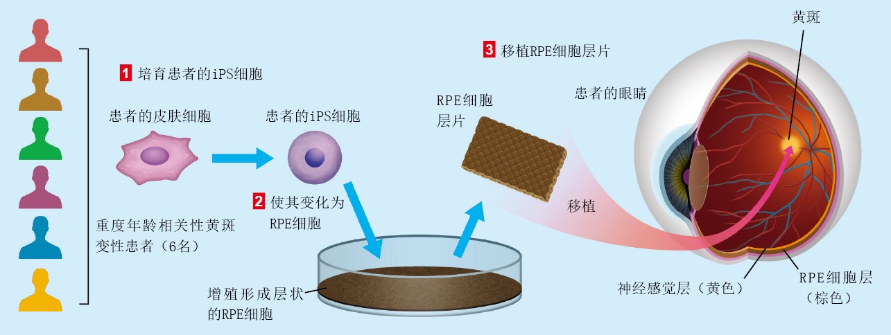 20130265用iPS细胞修补组织和器官_f1.jpg